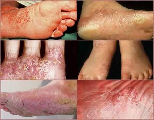 DESSHIDROTIC Etapa