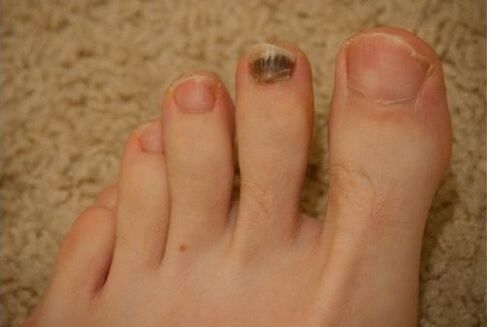 Ahozko eta topiko sendagaiak erabiltzea