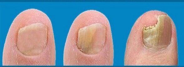 onddoen garapen prozesua