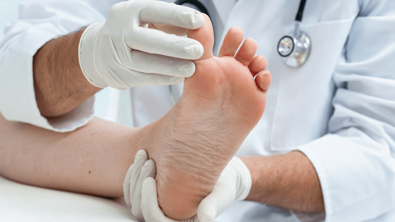 Oinetako onddoen diagnostikoa